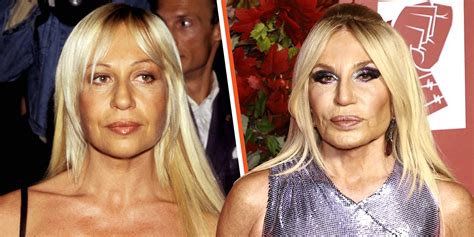 donatella versace e la chirurgia|donatella versace before and after.